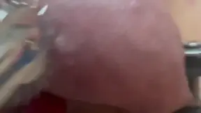 Shark teeth on besties balls