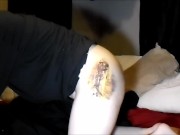 Dr will be mad! Post-Surgery Cum while Still Recovering FTM