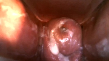 Play with Speculum and view inside my Pussy by inside Camera