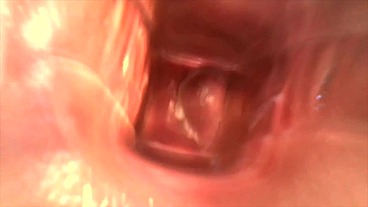 Play with Speculum and view inside my Pussy by inside Camera