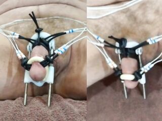 Fine shaking and pulsing with a massive HFO ESTIM load