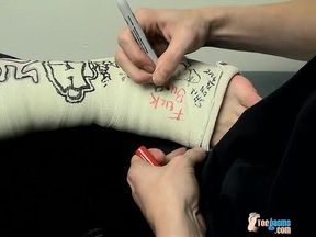 Foot Cast for Poor Evan