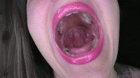 Alco yawn wmv