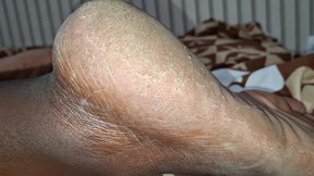 The Pig Has Big Legs and Asked a Cuckold to Come Lick the Cuckold Album Available There