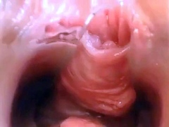 Webcam Pussy Play with Speculum