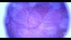 Beautiful Inside POV of My Full Bladder with the Endoscope!