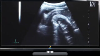 пара, без седла, члены, врач, медицина – парни с большими членами трахаются в задницу