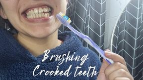 Brushing crooked teeth