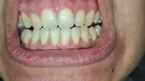 The details of my teeth