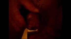 injection de vinaigre dans l'uretre