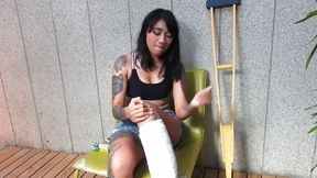 Tattooed Asian model with short cast leg