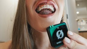 ASMR Q&A with Bulky Tongue Crib Device In