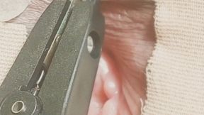 Needling to the clitoris.