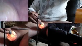 inflated light foreskin with 3 cam and endoscope inside