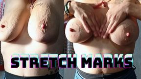 Stretch marks on my natural tits