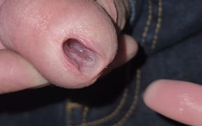 Gaping Urethra - Marker and Pinky Insertion