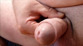 HOME - FORESKIN - CLOSE-UP