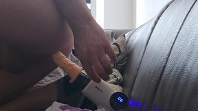 Anal augmentation