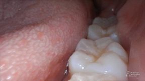 Macro endoscope mouth tour 2