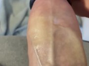 Thick veins