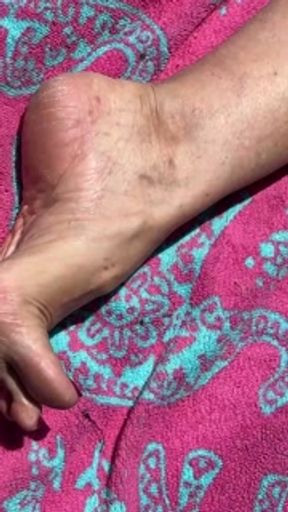 Fan Request Granny Naked In Sun Shows Dirty Rough Soles &amp; Toes GILF 2