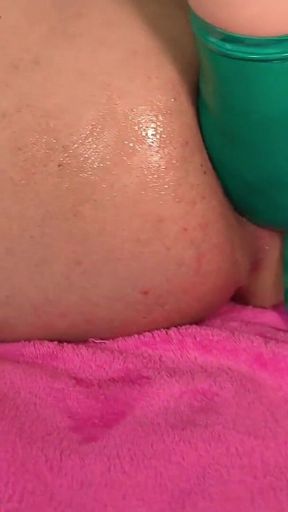 The Diagnosis Is Anal Slut: Pegging, Fisting and Foot Worship