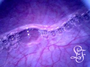 I really love taking a look into my deepest insides!