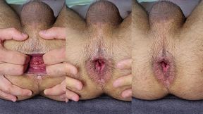 Gape and stretch my loose ass - ruined cum at the end