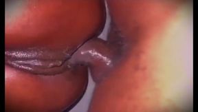 Deep Anal Penetration: Too Much for Me