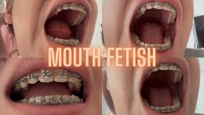 Mouth fetish, vore fantasy