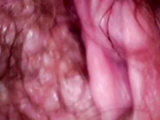 INSIDE THE URETHRA peehole big beautiful woman Aged mother I'd like to fuck endoscope