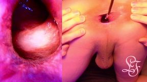 split screen look inside lina s gaping ass with eggs