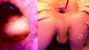 split screen look inside lina s gaping ass with eggs