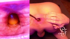 split screen look inside lina s gaping ass with eggs