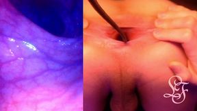 split screen look inside lina s gaping ass with eggs