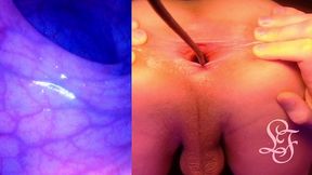 split screen look inside lina s gaping ass with eggs