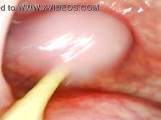 BIZARRE ANAL POV. CAMERA INSIDE HER DARK HOLE AS I POUND HER WITH MY LARGE RAMROD AND CUM UNFATHOMABLE INSIDE
