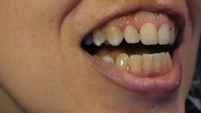 Scratch and Floss Dirty Teeth