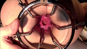 German sissy sluts extreme anal gaping