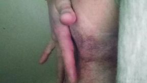 Digital rectal exam