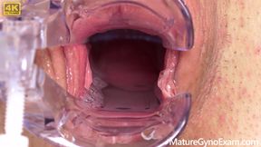 Cervix of Shy MILF Revealed!