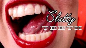 Slutty Teeth - WMV
