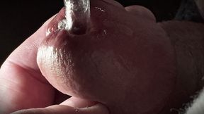 Masturbation