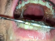 new horny deepthroat after pissing on my braces