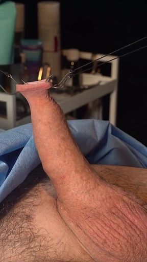 Needle CBT at It's Finest.