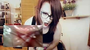 Endoscope Trip In My Ass Farts & Anal Orgasm With Contractions