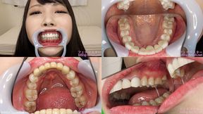 Kurumi - Watching Inside mouth of Japanese cute girl bite-193-1 - wmv