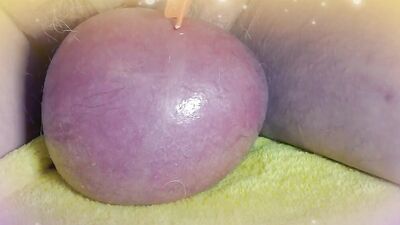 Perverted guy injects saline in his scrotum to make it larger