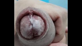 Zito kopela na tin xuno