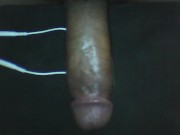 e-stim